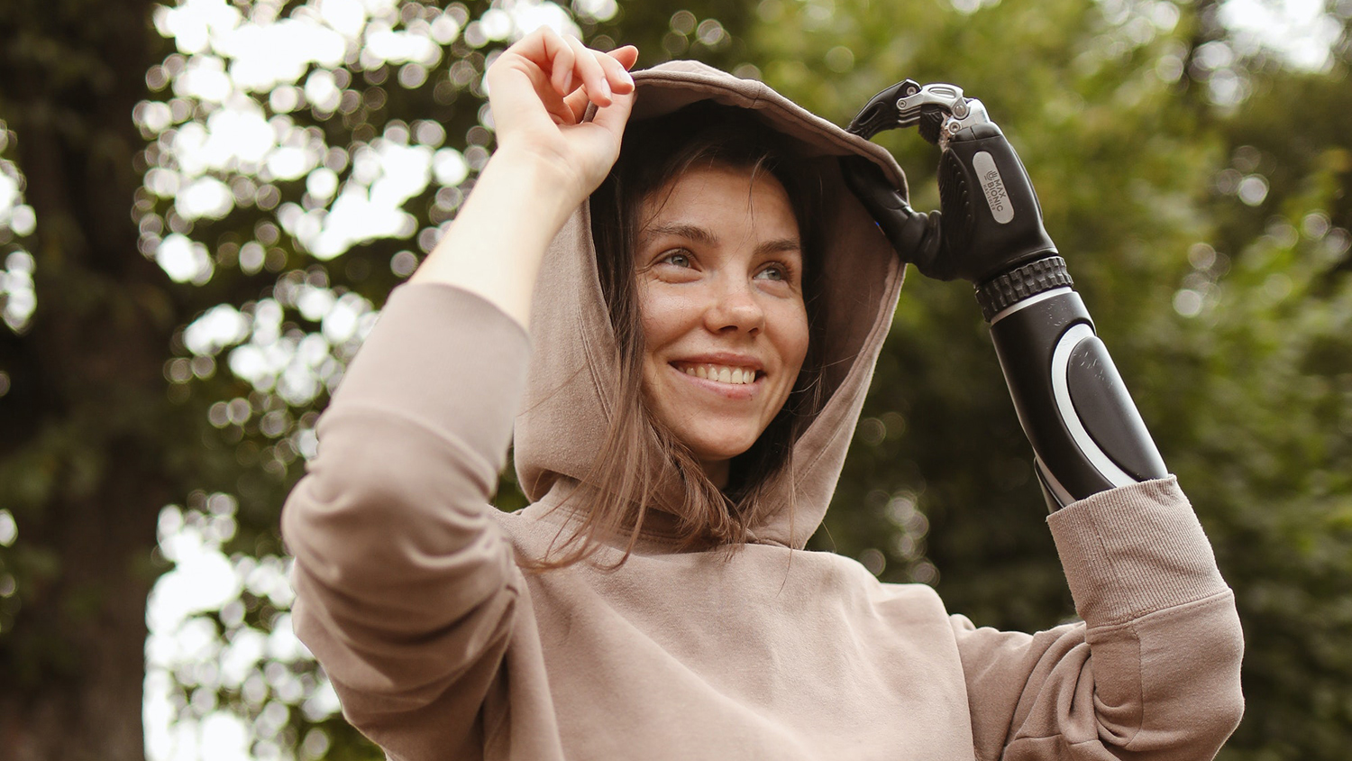 Kobieta z protezą ręki - ubezpieczenie od niezdolności do pracy zawodowej